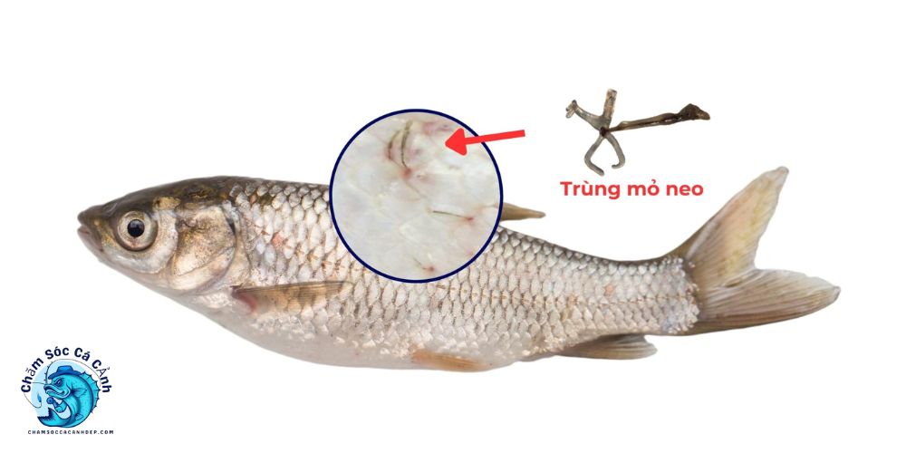 Tổng Quan Về Bệnh Trùng Mỏ Neo