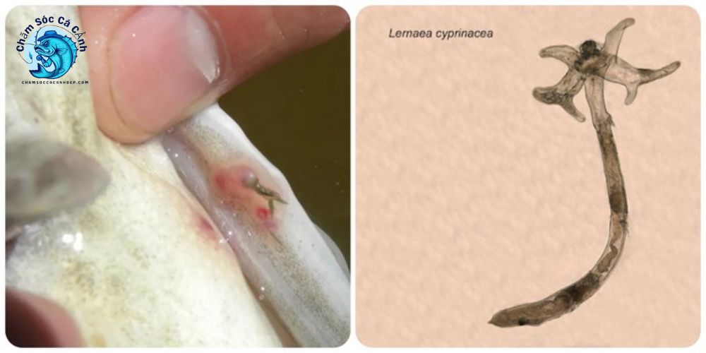 Mức Độ Nguy Hiểm Của Bệnh Trùng Mỏ Neo