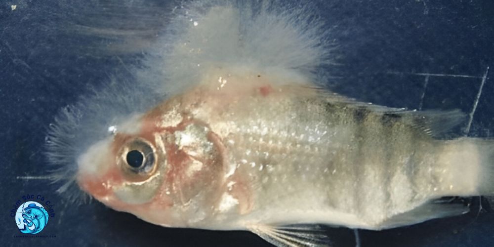 Nấm thuỷ mi - Dấu hiệu, nguyên nhân và cách điều trị hiệu quả